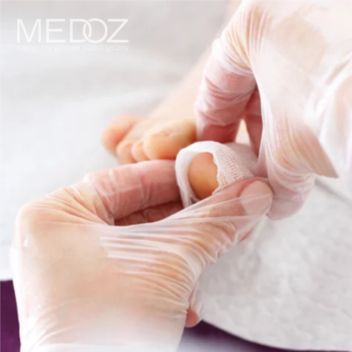 MEDOZ Medyczny gabinet podologiczny bydgoszcz podolog leczenie wrastających paznokci